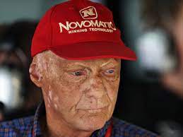 His was a life of great success but also dark moments. Niki Lauda Lungentransplantation Nach Lungenerkrankung Zustand Ernst Arzt Zuversichtlich Eurosport