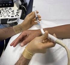 Image result for Hand Injection