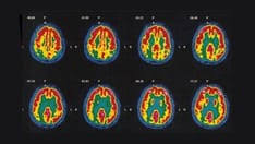 Image result for Paranecepsia