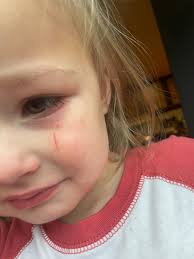 Autism Parents Support Group