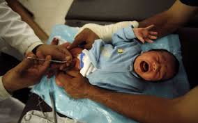 Lekapan zakar berkembang apabila kulit batang zakar melekat atau melekat pada kulit kepala zakar, juga dikenal sebagai kelenjar. Kebaikan Bersunat Manfaat Serta Risikonya Terhadap Kaum Adam