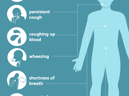 If you have a persistent cough, tell your doctor immediately, notes the go2 foundation for lung cancer. Lung Cancer Symptoms How Do You Know If You Have Lung Cancer Swasthya Shoppe