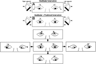Image result for Skew deviation