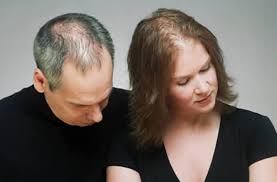 By tyler cole on june 22, 2014 6 comments. Prp Hair Loss Treatment Cost Archives Almeka Medical Centre
