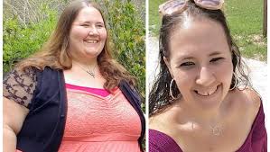 Fundraiser by Elizabeth Goodman : Skin Removal Surgery