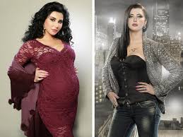 شاهد صور قبل وبعد عمليات التجميل الجراحية وغير الجراحية في ايران. Ø§Ø³ØªØ¹ÙŠØ¯ÙŠ Ø±Ø´Ø§Ù‚ØªÙƒ Ø¨Ø¹Ø¯ Ø§Ù„Ø¥Ù†Ø¬Ø§Ø¨ Ø¨Ø³Ø±Ø¹Ø© Ø§Ù„Ù†Ø¬Ù…Ø§Øª Ù…Ø¬Ù„Ø© Ø³ÙŠØ¯ØªÙŠ