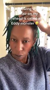 Meaning of Eddie Wolf Hairline