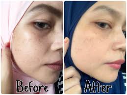 Diuji secara klinikal oleh ahli dermatologi, produk ini. Random Rainbow Eucerin Ultra White Spotless Review