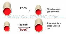 Tadalafil belongs to a group of medicines called phosphodiesterase 5 (pde5) inhibitors. Generic Cialis Tadalafil 2 5mg 5mg 10mg 20mg40mg Dosage Uses Warnings Side Effects