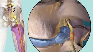 The cerebellum (back of brain) is located at the back of the head. Burning Sensation Causes And Treatment