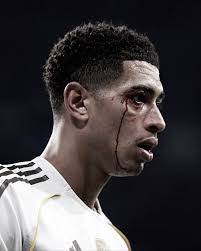 🚨 RED CARD! Benito Ramírez del Toro is shown a direct red card for a harsh  foul