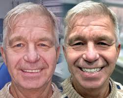 Live Fabric Sale- Sunday (16/03/25)  