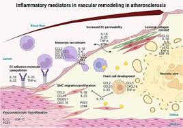 نتیجه جستجوی لغت [inflammatory] در گوگل