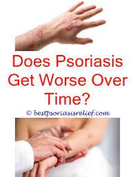 Ispsoriasisitchy Omega 3 6 9 Psoriasis Do Vegans Get Psoriasis Footpsoriasis Psoriasis Cure Natural Cure For Psoriasis Psoriasis Treatment