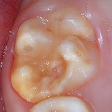 As a key initiative of mayor de blasio's housing plan, housing new york, the department of city planning is launching a mandatory inclusionary housing program that will require through zoning actions a. Mih Campaigns Gceurope