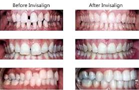 Best Pediatric Orthodontist Near Me Invisalign Cosmetic Dentistry Orthodontist