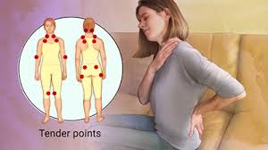 Aus wikimedia commons, dem freien medienarchiv. Fibromyalgia Pain Natural Treatment Acupuncture In Downingtown Pa