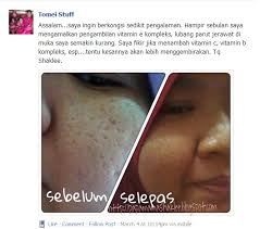 Ubat Untuk Parut Jerawat Berlubang Bertanya C