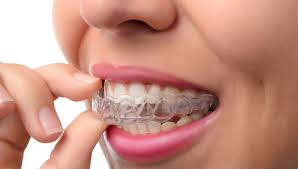 Raten zahnärzte zu einem besuch beim kieferorthopäden, löst das bei eltern viele fragen aus. Zahnspangen Kieferorthopaden Behandlung Medspecialists