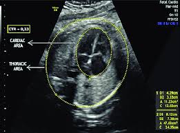 The chest is the area of origin for many of the body's systems as it houses organs such as the heart, esophagus, trachea, lungs, and thoracic diaphragm. Relationship Between The Heart And Chest Areas Obtained By Planimetry Download Scientific Diagram