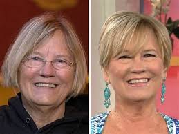 How do women get rid of wrinkles?