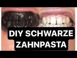 Das mysmile zahnaufhellungsset ist ideal, um die helligkeit ihrer zähne zu verbessern und auch kraftvoll zu steigern. Aktivkohle Zahne Auf Naturliche Art Und Weise Aufhellen Dasschoeneselbst