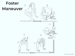 Image result for Vertigo Management