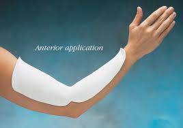 Image result for Long Arm Splint