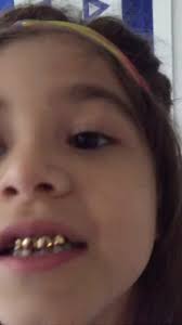 ✡️WordofmouthGold 🚧👑🦷🇺🇸 (@wordofmouthgoldz) • Instagram photos and  videos