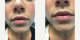 Beauty Lab and Laser