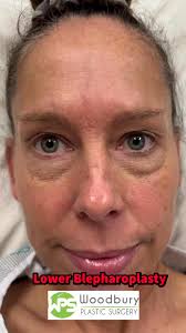 Dr. Charles Vang is a Family Practice Physician in MN since 2017. Dr.  Charles will be there at the health fair to answer any medical questions.  Hope to see y'all there. #hmahealthfair2025 #