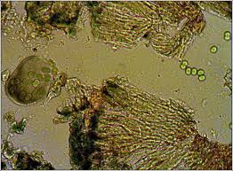 Image result for Globia algae