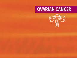 Because the signs of ovarian cancer are common and somewhat vague, it's hard to know when to call the doctor. Treatment Of Recurrent Ovarian Cancer Cancerconnect