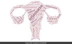 Signs and symptoms of pcos include irregular or no menstrual. Polycystic Ovary Syndrome Pcos 9 Early Signs And Symptoms You Must Not Ignore