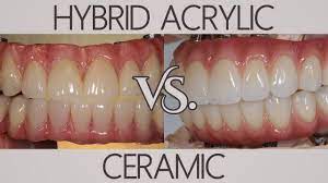 What S The Difference Between Acrylic And Ceramic Patients Ask Youtube