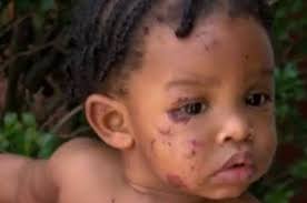 GRAPHIC CONTENT: 2-year-old allegedly attacks 9-month-old at daycare »  https://buff.ly/2OS97kc