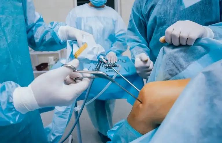 Knee Arthroscopy product image
