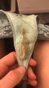 Du behøver ikke oppsøke jordmor eller lege, festeblødning gir seg av seg selv. Hva Er Dette Nasti Bilde Side 2 Provere Og Ufrivillig Barnlose Kvinneguiden Forum