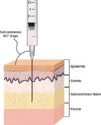 Maybe you would like to learn more about one of these? How To Administer An Insulin Injection