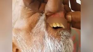 Traumatized Son Shares Video Of Maggots In Hospitalized Father S Mouth Ctv News