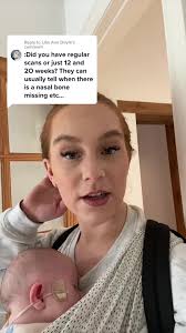 Replying to @Libs Ann Doyle #downsyndrome #newbornsoftiktok  #downsyndromeawareness