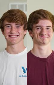 We are identical twins