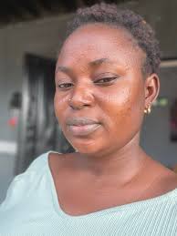 How to remove pimples from a face?