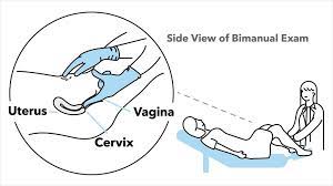 What Is A Pelvic Exam Questions About Gynecology Exams