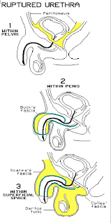 Buck's fascia (deep fascia of the penis, gallaudet's fascia or fascia of the penis) is a layer of deep fascia covering the three erectile bodies of the penis. Perineum Flashcards Memorang