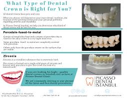Dental Crown Zirconia Porcelain Veneers