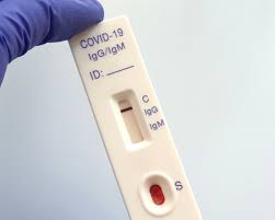 Wykonaj serologiczny test na koronawirusa przesiewowy i sprawdź, czy miałeś kontakt z koronawirusem. Testy Na Przeciwciala Koronawirusa Sars Cov 2 Dla Kogo I Czy Warto