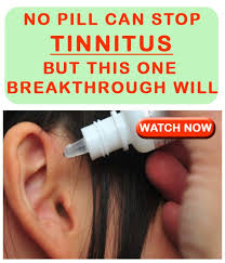 Imagine A Constant Ringing Buzzing Or Whistling In Your Ear 24 Hours A Day This Is Usually Known As Tinnitus It Is The Term For Hearing Treatment For Tinnitus Tinnitus