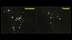 Nei test preliminari sull'uomo ha mostrato la capacità di diminuire la quantità di placche amiloidi, l'accumulo di proteine nel cervello che è considerato. Farmaco Sperimentale Per Far Regredire L Alzheimer Funziona Nei Topi