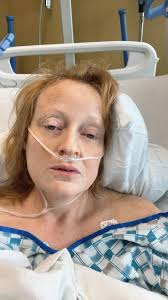 Lf anterior hip replaced 7 weeks ago- I feel like pain is worse week 7 in  thigh, knee and back then in previous weeks. Has anyone else experienced  this?